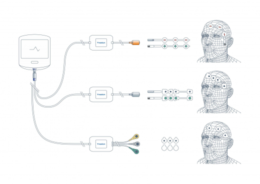 Depth of anesthesia and sedation module MGA